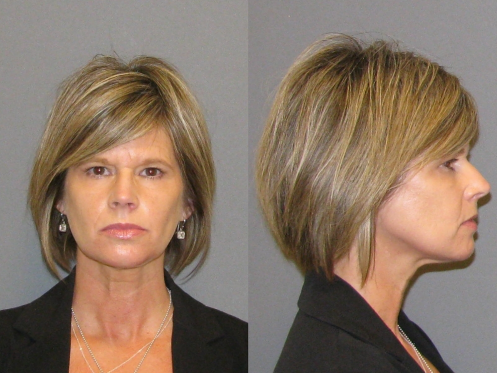 Warrant issued for the arrest of Dede Evavold